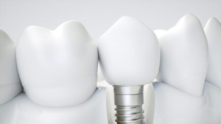 Enhancing product capabilities to improve performance